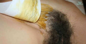 The pubic hair is being removed with the Brazilian Wax